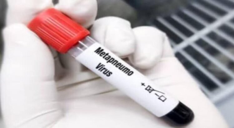 Aparece el primer caso en San Luis, de Metapneumovirus (HMPV)