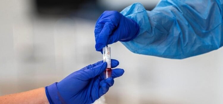 El estado de San Luis Potosí suma 4 casos de Covid-19 y 21 de influenza en una semana