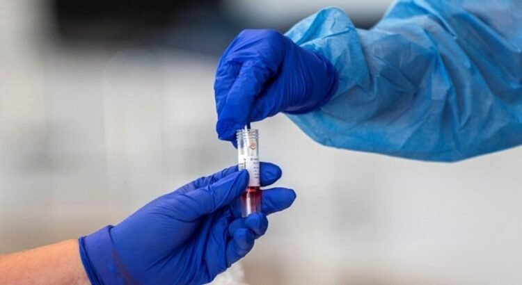 El estado de San Luis Potosí suma 4 casos de Covid-19 y 21 de influenza en una semana